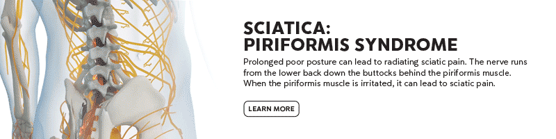 Sciatica: Piriformis Syndrome - Learn More CTA