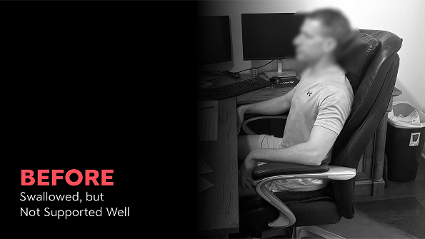 Posture_Thumbnail_E_Before 1