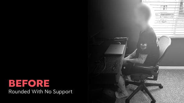 Posture_Thumbnail_G_Before 2